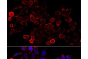 Immunofluorescence analysis of HeLa cells using KAT7 Polyclonal Antibody at dilution of 1:100 (40x lens). (MYST2 抗体)