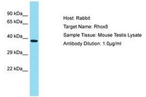 Image no. 1 for anti-Reproductive Homeobox 8 (RHOX8) (AA 180-229) antibody (ABIN6750292) (RHOX8 抗体  (AA 180-229))