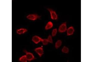 ABIN6275396 staining NIH-3T3 by IF/ICC. (Prosaposin 抗体  (Internal Region))