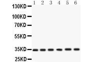 Western Blotting (WB) image for anti-Cyclin-Dependent Kinase 4 (CDK4) (AA 201-303) antibody (ABIN3043745) (CDK4 抗体  (AA 201-303))