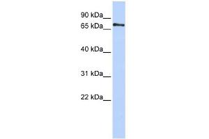 WB Suggested Anti-PHACTR1 Antibody Titration: 0. (PHACTR1 抗体  (Middle Region))