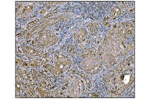 IHC analysis of HCCS using anti-HCCS antibody (ABIN7602424).