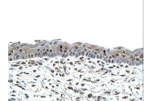 Immunohistochemistry (IHC) image for anti-Centromere Protein A (CENPA) (N-Term) antibody (ABIN2782448) (CENPA 抗体  (N-Term))