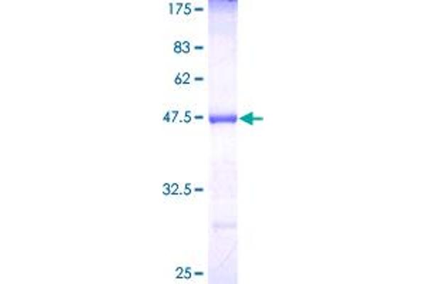 MTAP Protein (AA 1-154) (GST tag)