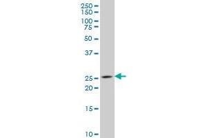 NKX3-1 monoclonal antibody (M02), clone 1C7 Western Blot analysis of NKX3-1 expression in NIH/3T3 .