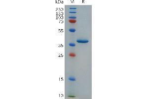 SDS-PAGE (SDS) image for Platelet Factor 4 (PF4) (AA 34-101) protein (Fc Tag) (ABIN7490751)