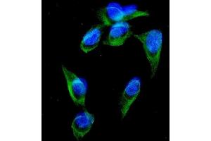 IF analysis of GRK3 using anti-GRK3 antibody (ABIN3043729).