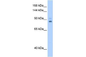 WB Suggested Anti-TPX2 Antibody Titration:  0. (TPX2 抗体  (C-Term))