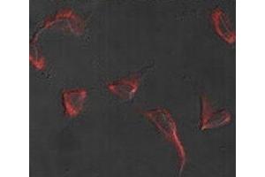 Immunofluorescence analysis of Nestin antibody and HeLa cells. (Nestin 抗体  (AA 1560-1590))