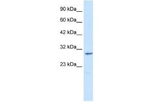 CLIC2 antibody used at 1. (CLIC2 抗体  (Middle Region))