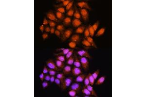 Immunofluorescence analysis of HeLa cells using ADK Rabbit pAb (ABIN7265463) at dilution of 1:100. (ADK 抗体  (AA 200-345))