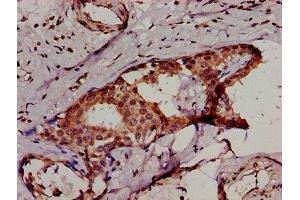 Immunohistochemistry (IHC) image for anti-Inhibitor of kappa Light Polypeptide Gene Enhancer in B-Cells, Kinase beta (IKBKB) (AA 395-588) antibody (ABIN7156261)