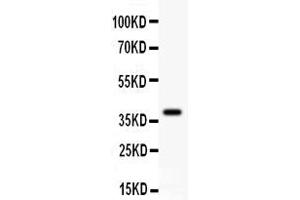 Anti- GAD67 Picoband antibody, Western blottingAll lanes: Anti GAD67  at 0. (GAD 抗体  (AA 14-122))
