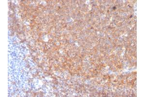 Immunohistochemistry (IHC) image for anti-CD19 Molecule (CD19) (AA 96-281) antibody (ABIN6941102)