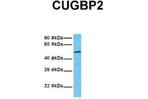 Host:  Rabbit  Target Name:  CUGBP2  Sample Tissue:  Human 293T  Antibody Dilution:  1.