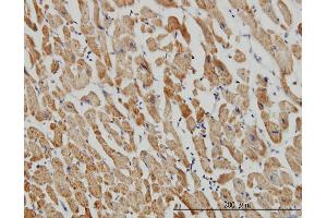 Immunoperoxidase of monoclonal antibody to ACOT9 on formalin-fixed paraffin-embedded human heart. (ACOT9 抗体  (AA 1-212))