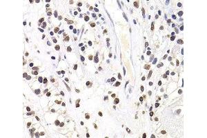 Immunohistochemistry (Paraffin-embedded Sections) (IHC (p)) image for anti-SRY (Sex Determining Region Y)-Box 5 (SOX5) antibody (ABIN7262915)