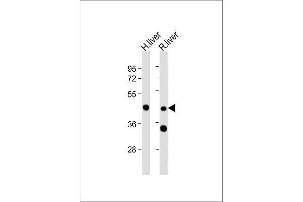 WIPF3 抗体  (N-Term)