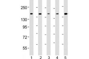 Western blot testing of human 1) K562, 2) Jurkat, 3) HeLa, 4) rat C6 and 5) human MOLT-4 cell lysate with CTCF antibody at 1:4000. (CTCF 抗体  (AA 445-727))