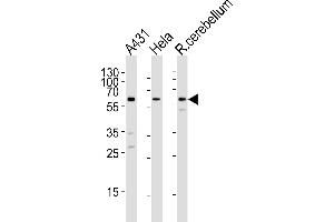 Western blot analysis of lysates from A431, Hela cell line and rat cerebellum tissue lysare(from left to right), using KISS1R Antibody (Center) (ABIN1881480 and ABIN2843217). (KISS1R 抗体  (AA 235-263))