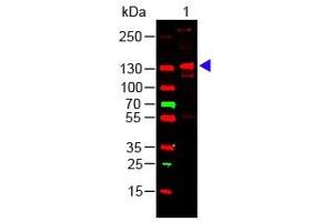 Lane 1: Human Collagen III. (COL3 抗体)