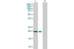 Western Blot analysis of ADI1 expression in transfected 293T cell line by ADI1 MaxPab polyclonal antibody. (ADI1 抗体  (AA 1-179))