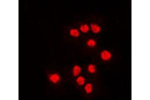 Immunofluorescent analysis of ATF7 staining in Jurkat cells. (AFT7 抗体  (Center))