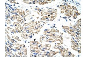 HNRPK antibody was used for immunohistochemistry at a concentration of 4-8 ug/ml to stain Skeletal muscle cells (arrows) in Human Muscle. (HNRNPK 抗体  (C-Term))