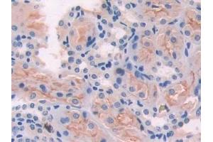 Detection of ADCY6 in Mouse Kidney Tissue using Polyclonal Antibody to Adenylate Cyclase 6 (ADCY6)