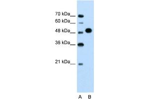 WB Suggested Anti-MKRN1 Antibody Titration:  1. (MKRN1 抗体  (N-Term))