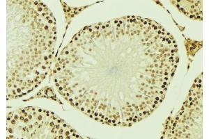 ABIN6276947 at 1/100 staining Mouse testis tissue by IHC-P. (RUVBL2 抗体  (Internal Region))