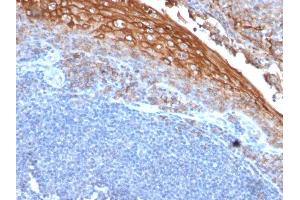 Formalin-fixed, paraffin-embedded human Tonsil stained with MUC18 Mouse Recombinant Monoclonal Antibody (rMUC18/1130). (Recombinant MCAM 抗体)
