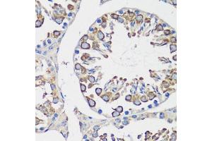 Immunohistochemistry (IHC) image for anti-Cyclin B1 (CCNB1) (C-Term) antibody (ABIN7266555)