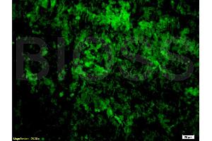 Immunofluorescence (IF) image for anti-Tumor Necrosis Factor alpha (TNF alpha) antibody (ABIN722481) (TNF alpha 抗体)