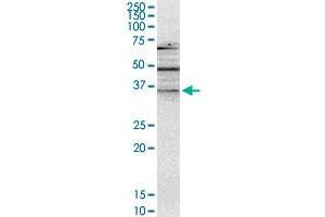 NMNAT2 monoclonal antibody (M02), clone 4E6. (NMNAT2 抗体  (AA 208-307))