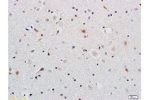 Immunohistochemistry (Paraffin-embedded Sections) (IHC (p)) image for anti-Excision Repair Cross Complementing Polypeptide-1 (ERCC1) (AA 151-250) antibody (ABIN733553)