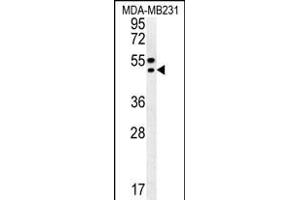 TR Antibody (C-term) (ABIN652176 and ABIN2840578) western blot analysis in MDA-M cell line lysates (35 μg/lane). (TRAM2 抗体  (C-Term))