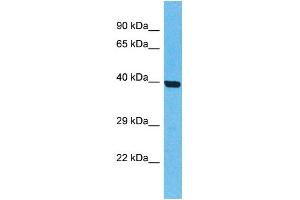 Western Blotting (WB) image for anti-Olfactory Receptor, Family 5, Subfamily T, Member 2 (OR5T2) (C-Term) antibody (ABIN2774565) (OR5T2 抗体  (C-Term))