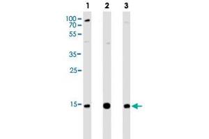 Western blot analysis of Lane 1: Hela cell line lysates Lane 2: THP-1 cell line lysates Lane 3: A431 cell line lysates reacted with VAMP8 monoclonal antibody  at 1:1000 dilution. (VAMP8 抗体  (N-Term))