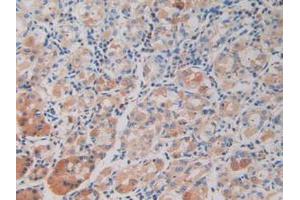 IHC-P analysis of Human Stomach Tissue, with DAB staining. (DDX58 抗体  (AA 550-776))