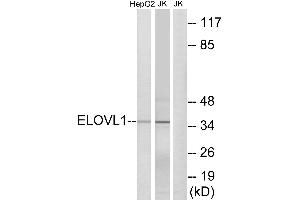 Western blot analysis of extracts from HepG2 cells and Jurkat cells, using ELOVL1 antibody. (ELOVL1 抗体  (Internal Region))