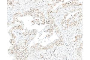Immunohistochemistry (IHC) image for anti-RNA Polymerase II (pSer2) antibody (ABIN7454655) (RNA Polymerase II 抗体  (pSer2))