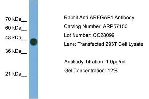 WB Suggested Anti-ARFGAP1  Antibody Titration: 0. (ARFGAP1 抗体  (Middle Region))