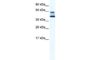 WB Suggested Anti-ZBTB7A Antibody Titration:  5. (ZBTB7A 抗体  (N-Term))