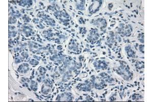 Immunohistochemical staining of paraffin-embedded breast tissue using anti-FCGR2A mouse monoclonal antibody. (FCGR2A 抗体)