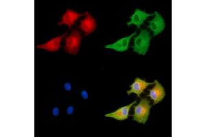 ABIN6263078 and ABIN6278934 staining  cells by IF/ICC. (MAGEF1 抗体  (Internal Region))