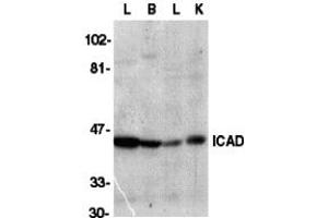 Western Blotting (WB) image for anti-DNA Fragmentation Factor, 45kDa, alpha Polypeptide (DFFA) (C-Term) antibody (ABIN1030428) (DFFA 抗体  (C-Term))