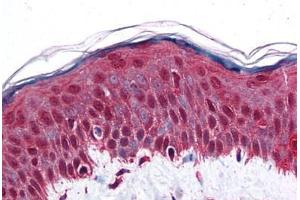 Human Skin: Formalin-Fixed, Paraffin-Embedded (FFPE) (Retinoblastoma Binding Protein 8 抗体  (AA 452-747))