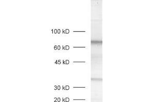 dilution: 1 : 1000, sample: rat retina extract (MPP4 抗体  (AA 197-216))