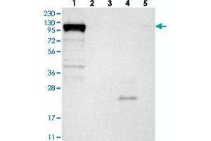 Western blot analysis of Lane 1: RT-4, Lane 2: U-251 MG, Lane 3: Human Plasma, Lane 4: Liver, Lane 5: Tonsil with DHX36 polyclonal antibody  at 1:250-1:500 dilution. (DHX36 抗体)